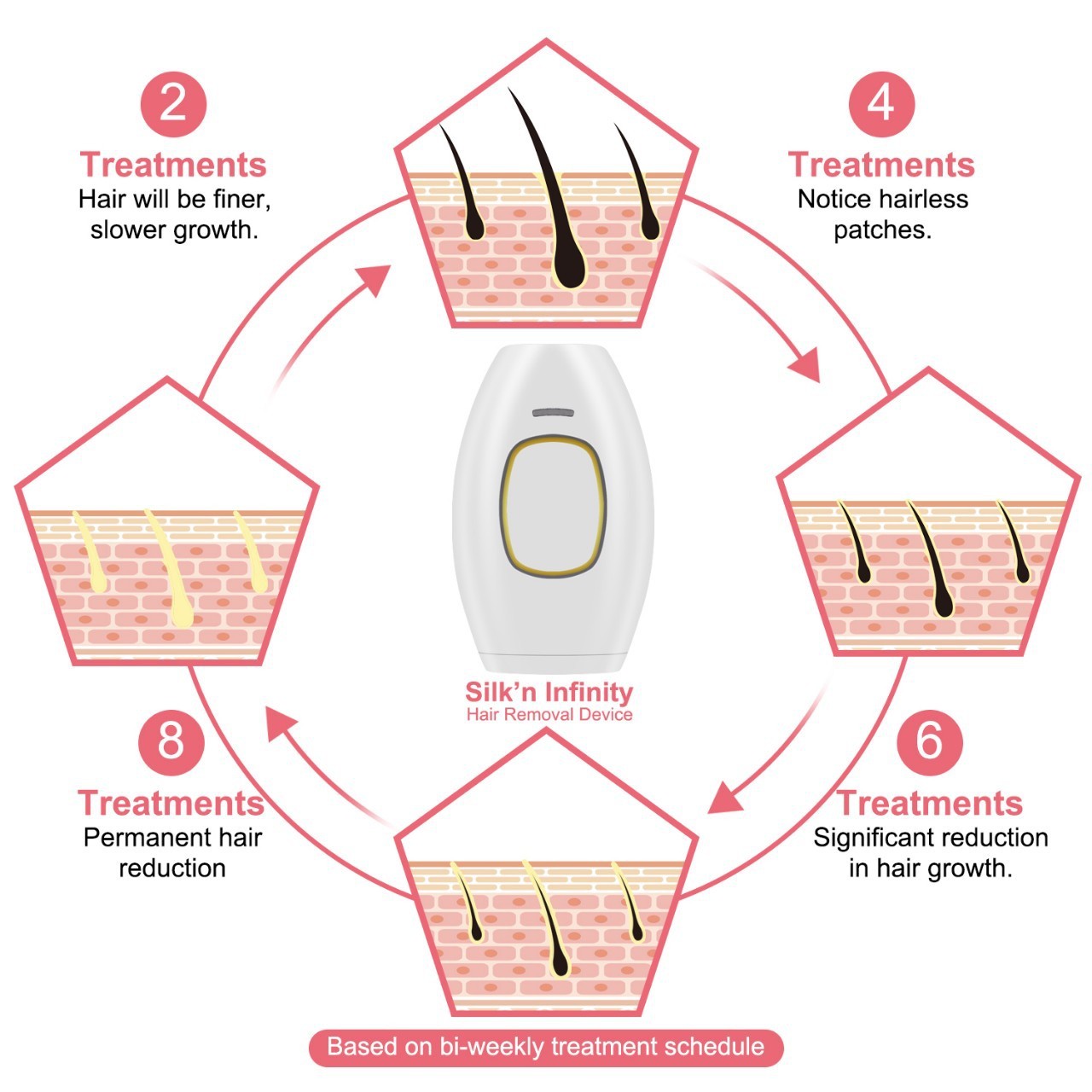 Freezing Point Laser Hair Removal Apparatus Handheld Facial Whole Body Beauty Apparatus Female ipl Photon Laser Hair Removal Apparatus