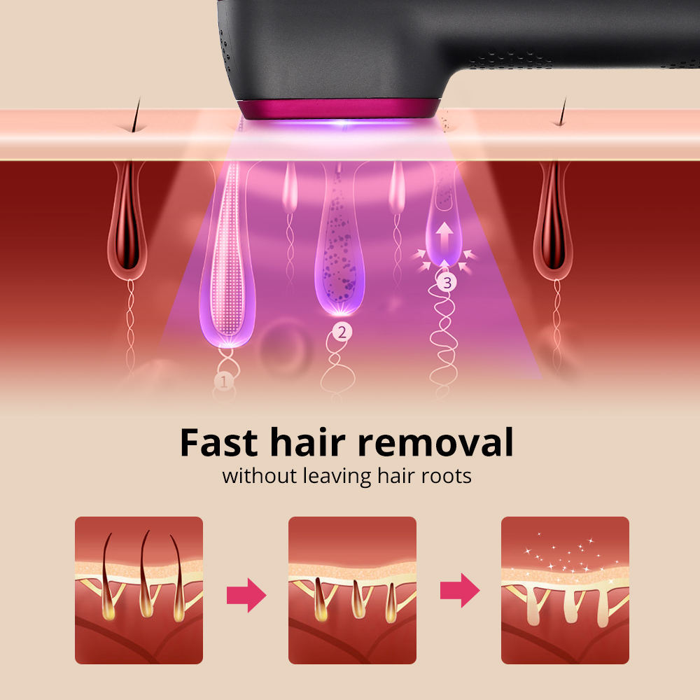 1PCS Laser Hair Removal For Women And Man 100,000 Flashes IPL Painless Laser Hair Removal